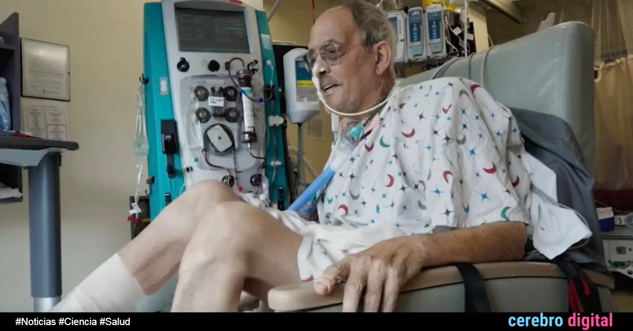 Trasplante experimental de corazón de cerdo: un mes después