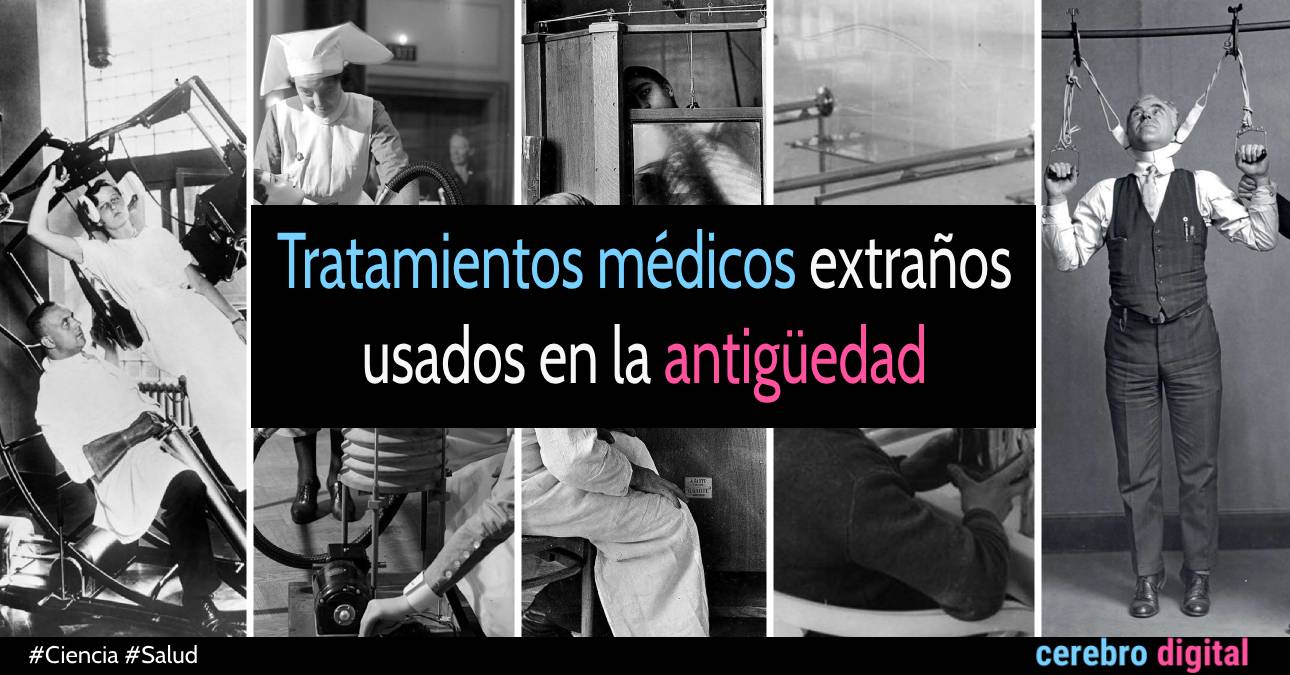 Tratamientos médicos extraños usados en la antigüedad