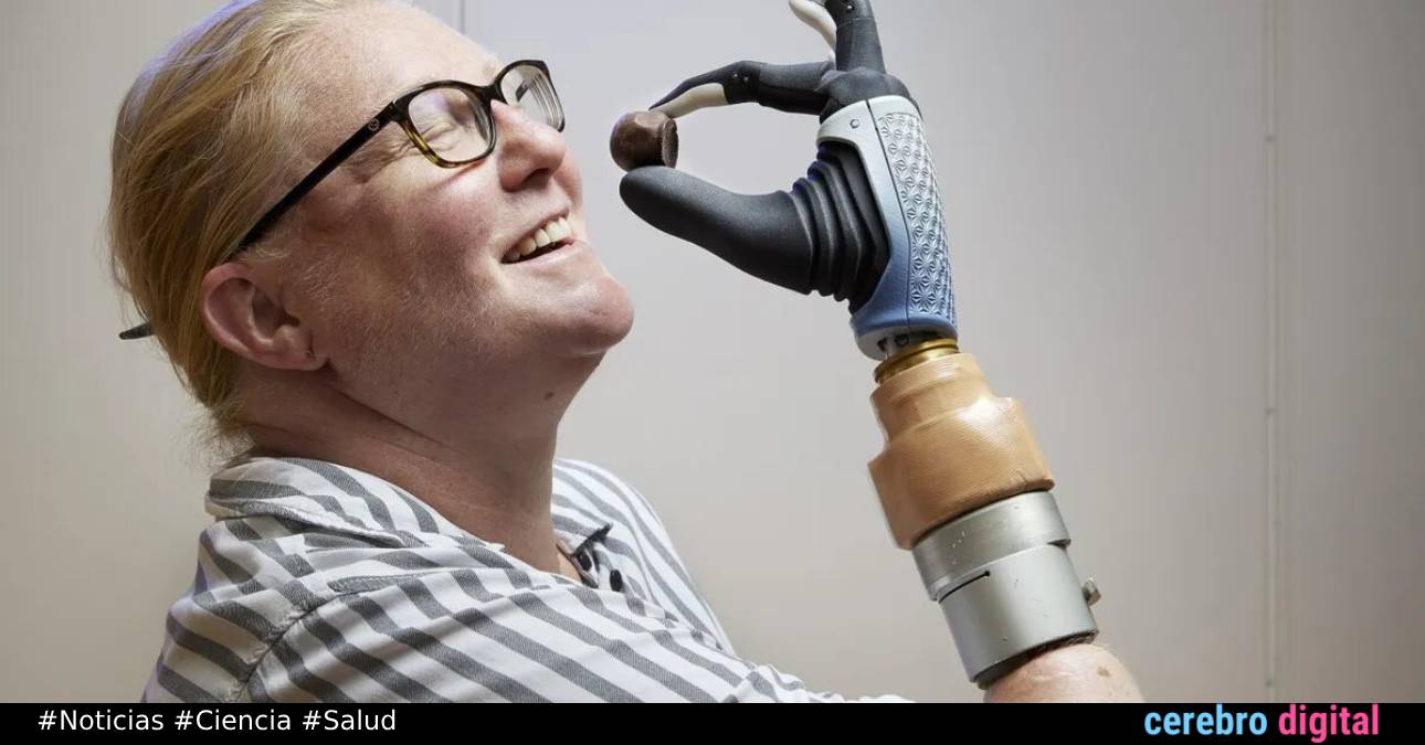 Una mano biónica que se fusiona con huesos, músculos y nervios