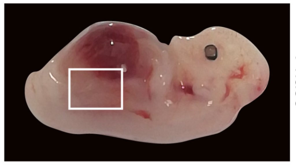 Quimeras creadas en laboratorio: cerdos con células cerebrales y chips biológicos 2 Quimeras creadas en laboratorio: cerdos con células cerebrales y chips biológicos