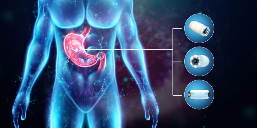 Así es la píldora-cámara que puede reemplazar a las colonoscopias