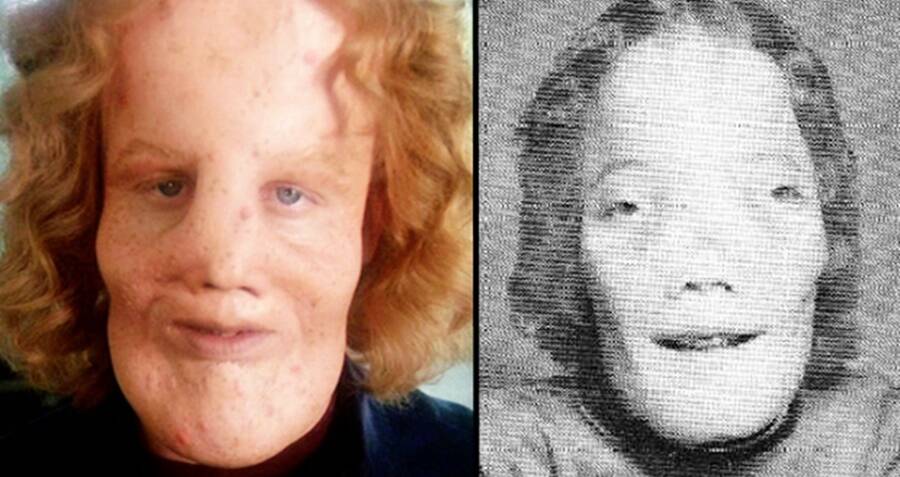 Rocky Dennis: la vida de un niño con una extraña deformidad 