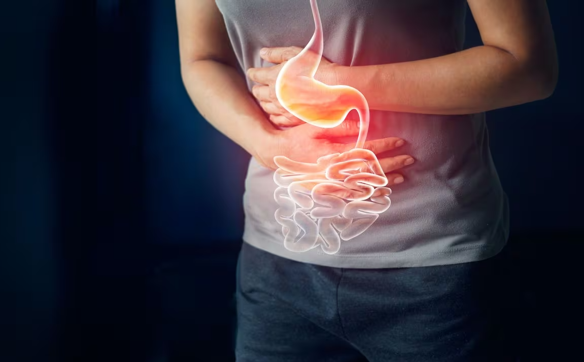 Cómo saber si tengo úlcera gástrica