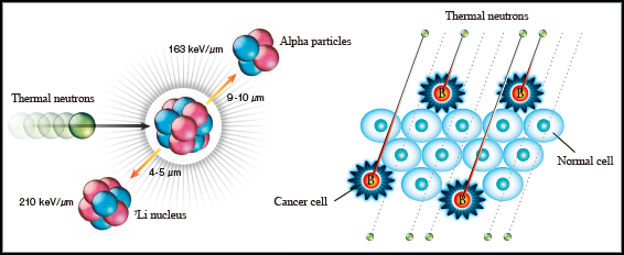 Japón es pionero en un nuevo tratamiento de radiación contra el cáncer 3 Japón es pionero en un nuevo tratamiento de radiación contra el cáncer