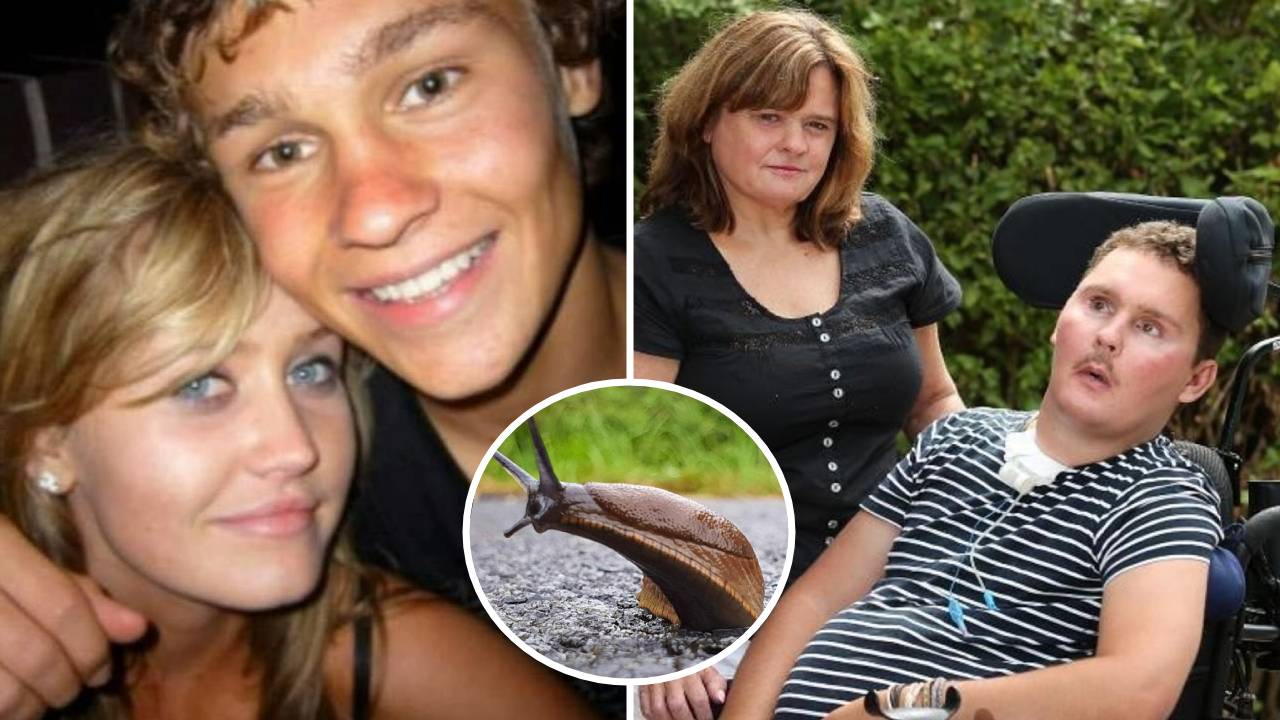 Consecuencias de comer una babosa: un hombre fallece después de 8 años de estar tetrapléjico 1 Consecuencias de comer una babosa: un hombre fallece después de 8 años de estar tetrapléjico