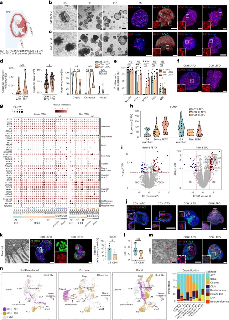 estudio sobre los Órganos Miniatura