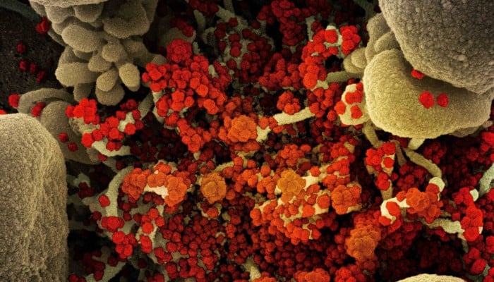 La infección por COVID del hombre duró casi 2 años, tiempo suficiente para desarrollar una nueva variante