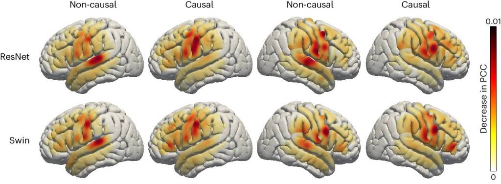Nueva investigación podría devolver el habla perdida a través de la decodificación neuronal 4 Nueva investigación podría devolver el habla perdida a través de la decodificación neuronal