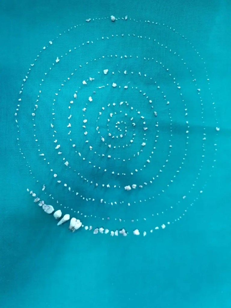 Descubren 526 dientes en la boca de un niño en la India 1 Los 526 dientes