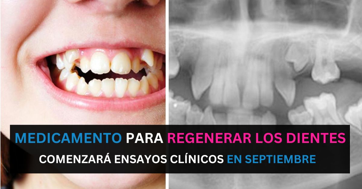 El primer medicamento para la regeneración y crecimiento de dientes se probará en septiembre 1 El primer medicamento para la regeneración y crecimiento de dientes se probará en septiembre