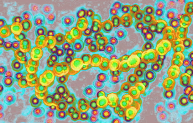 STSS (Streptococcal Toxic Shock Syndrome)