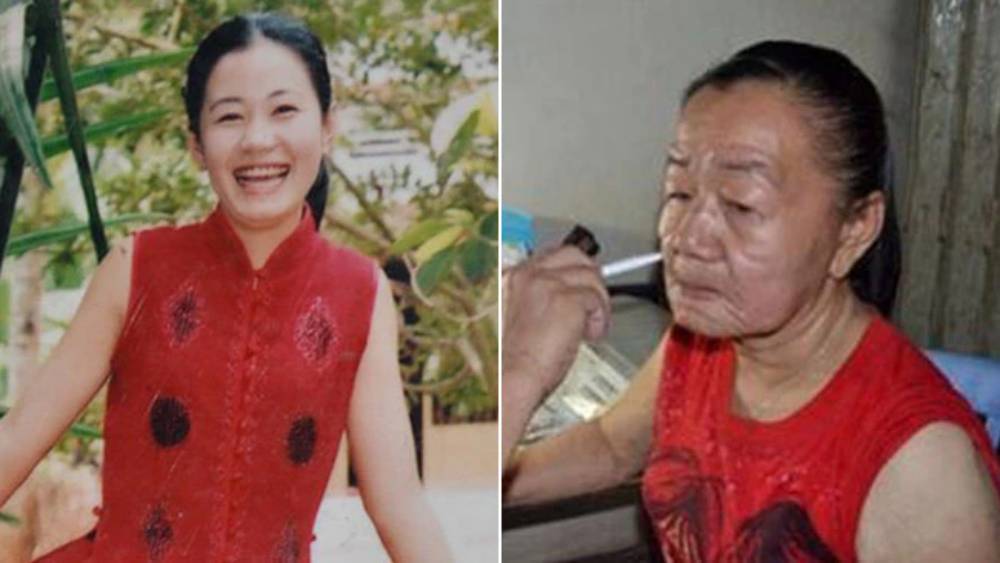 Nguyen Thi Phuong: El extraño caso de envejecimiento acelerado 1 Nguyen Thi Phuong: El extraño caso de envejecimiento acelerado