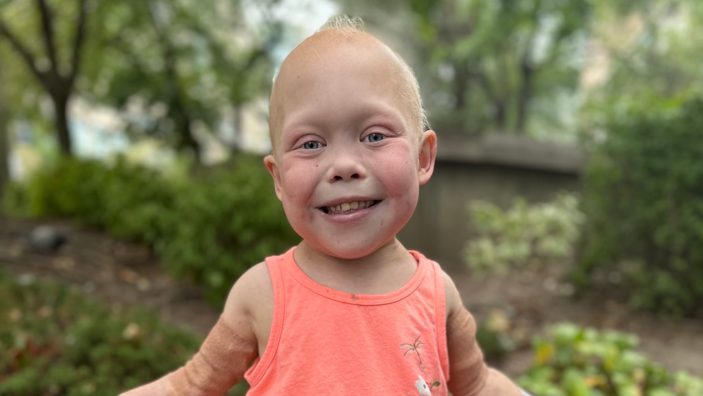 Bella Brave ha fallecido: la pequeña TikToker que enamoró al mundo a pesar de su enfermedad