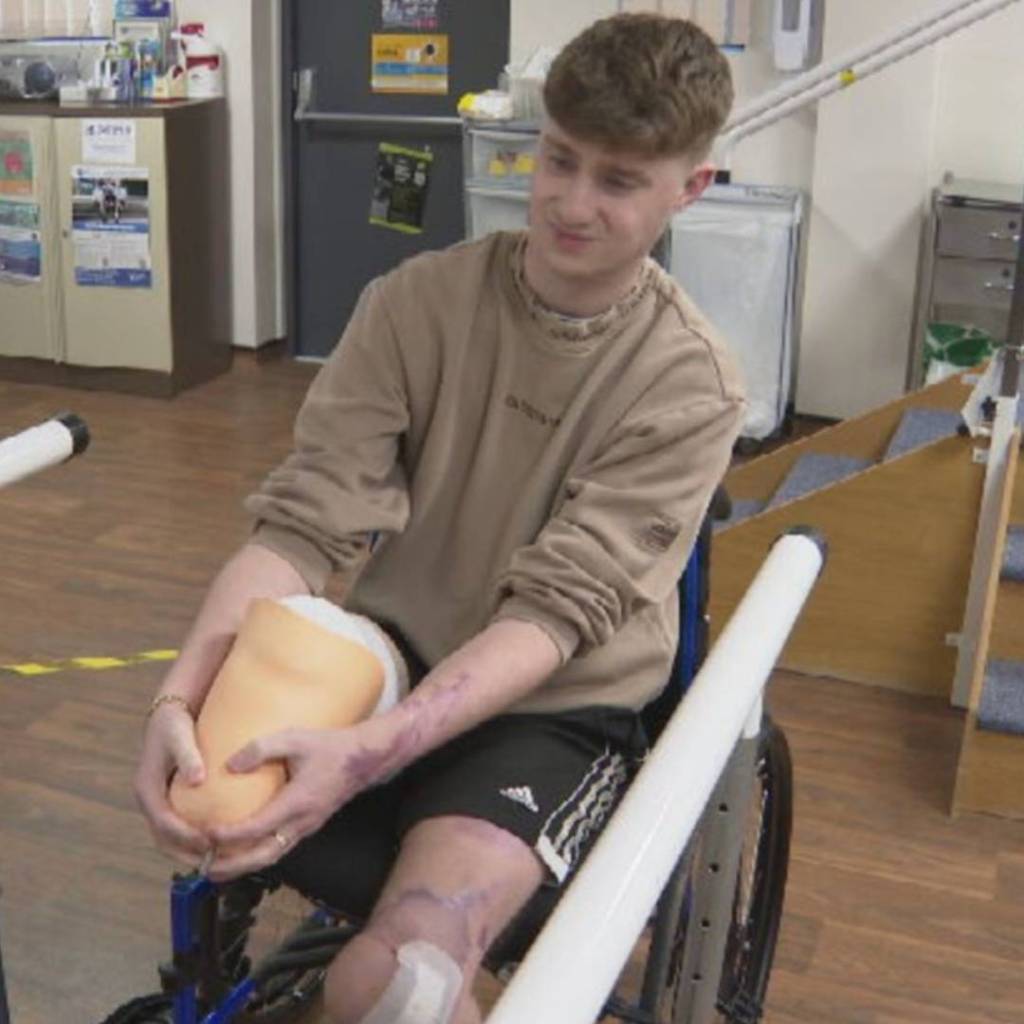 El paciente más enfermo del país: la historia de Levi Dewey