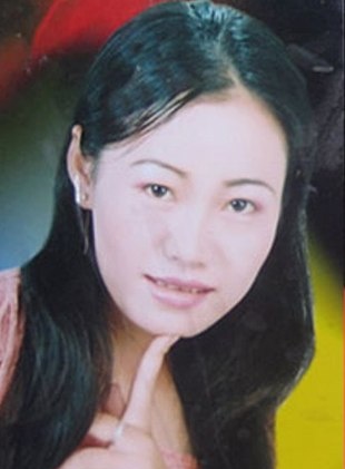 Nguyen Thi Phuong: El extraño caso de envejecimiento acelerado 2 Nguyen Thi Phuong: El extraño caso de envejecimiento acelerado