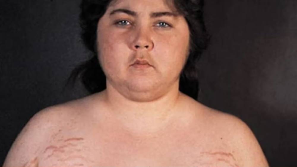 Nguyen Thi Phuong: El extraño caso de envejecimiento acelerado 3 Nguyen Thi Phuong: El extraño caso de envejecimiento acelerado