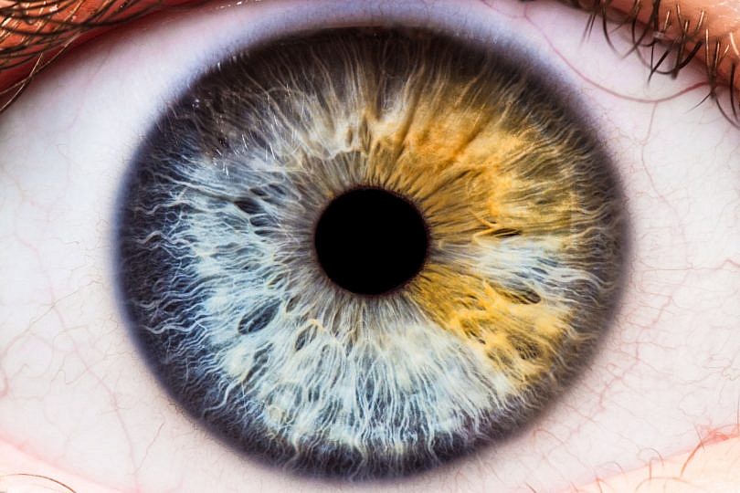 El nuevo color de ojos más raro del mundo