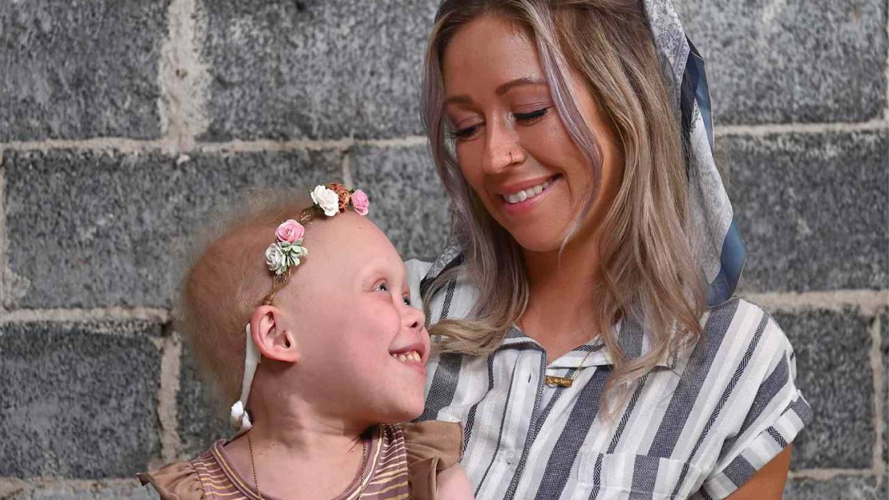 Bella Brave ha fallecido: la pequeña TikToker que enamoró al mundo a pesar de su enfermedad