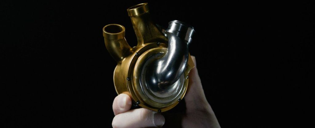 Primer implante mundial de un corazón de titanio que aprovecha la tecnología de levitación magnética 1 Primer implante mundial de un corazón de titanio que aprovecha la tecnología de levitación magnética