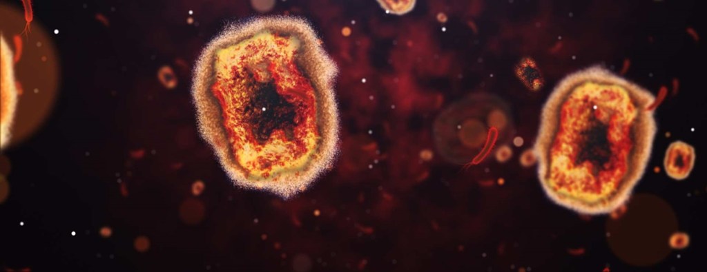 Viruela del Mono declarada emergencia de salud pública en África y causa alerta mundial