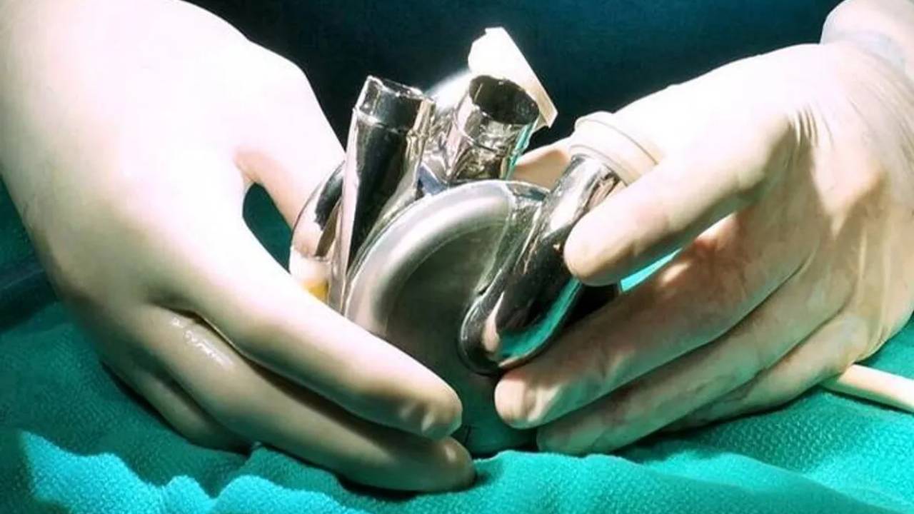 Primer implante mundial de un corazón de titanio que aprovecha la tecnología de levitación magnética