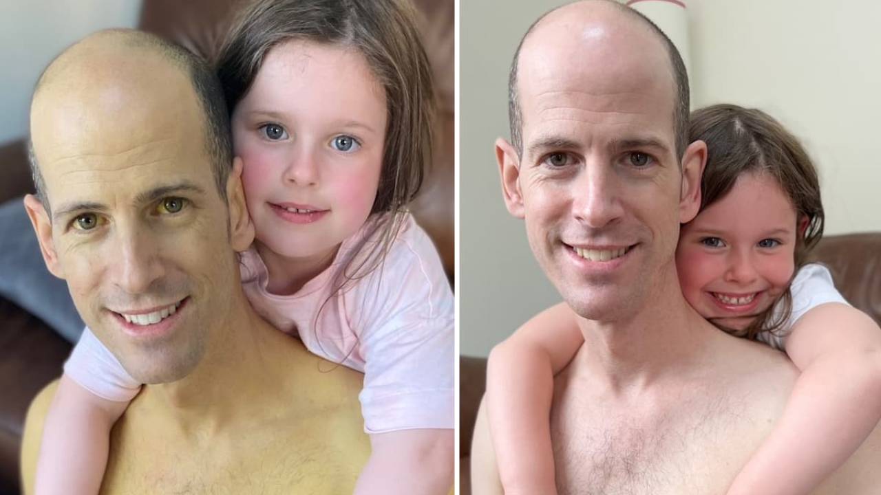 Trasplante de hígado: el increíble cambio de un hombre después de recibir uno