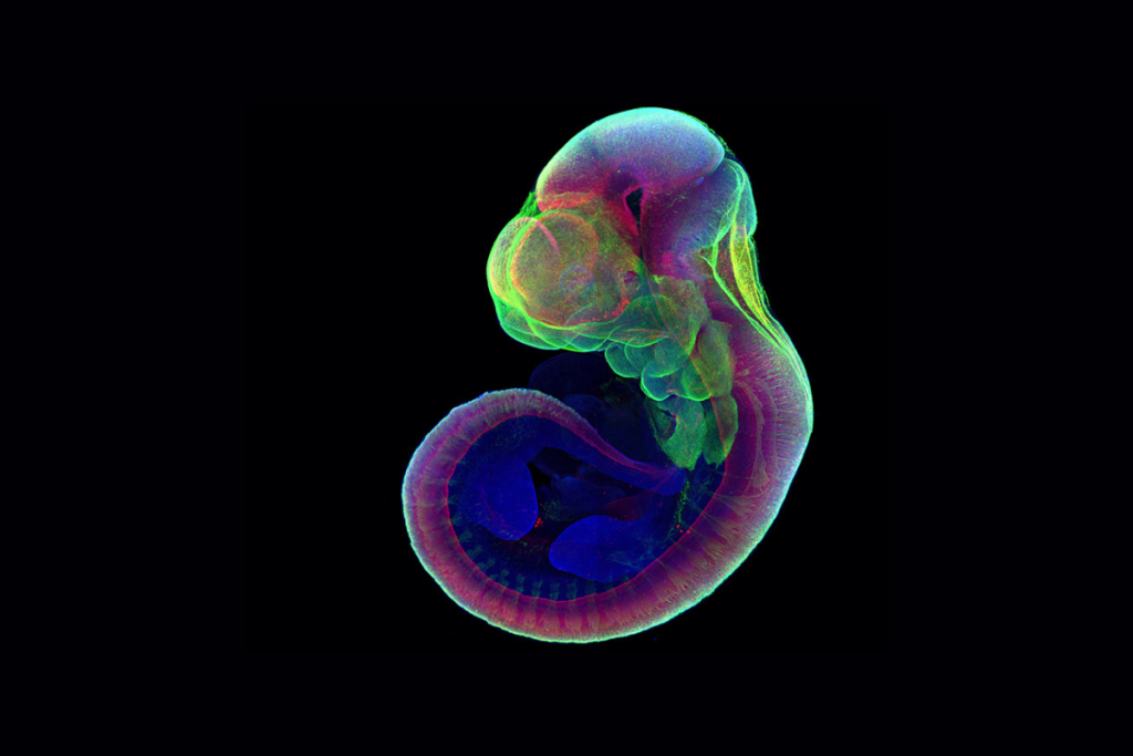 Úteros artificiales ¿El futuro de la reproducción? 1 Úteros artificiales ¿El futuro de la reproducción?