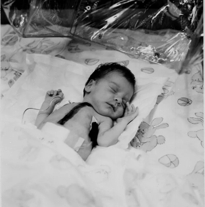 Baby Fae: ¿Qué sucedió cuando una niña recibió un trasplante de corazón de un babuino? 1 Baby Fae: ¿Qué sucedió cuando una niña recibió un trasplante de corazón de un babuino?