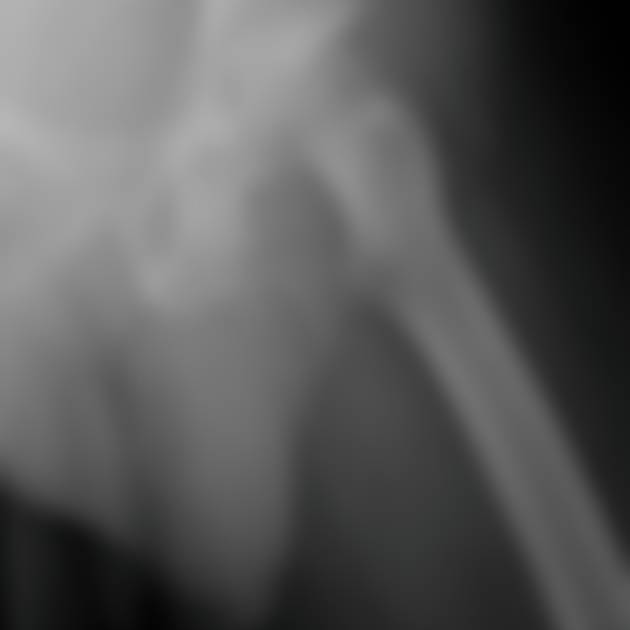 Autopsia reveló que un hombre de 78 años tenía 3 penes: un fenómeno médico rarísimo