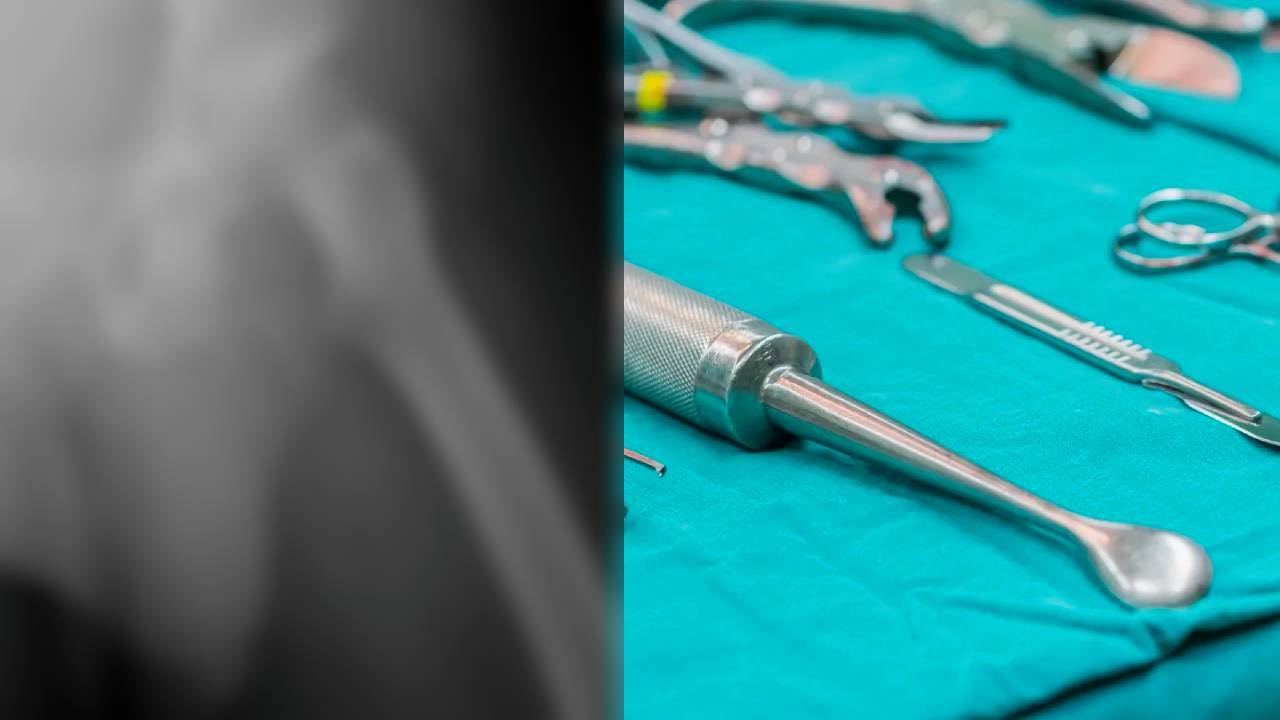 Autopsia reveló que un hombre de 78 años tenía 3 penes: un fenómeno médico rarísimo