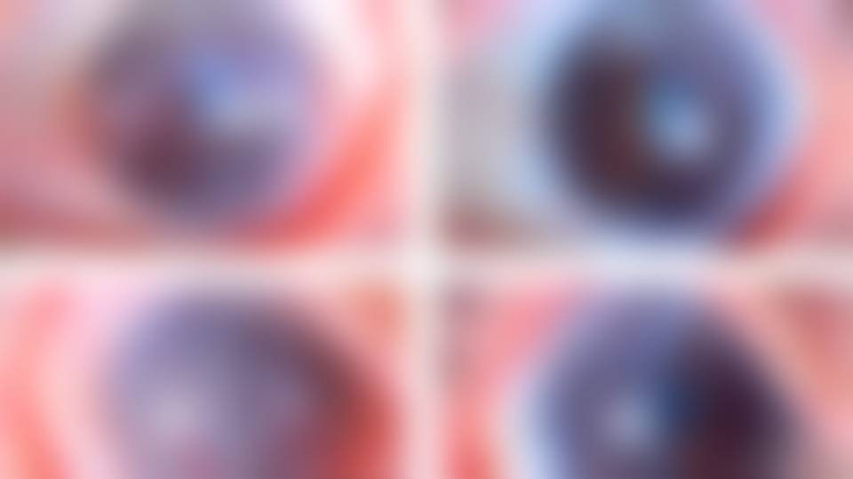 El primer tratamiento con células madre del mundo devuelve la visión a las personas