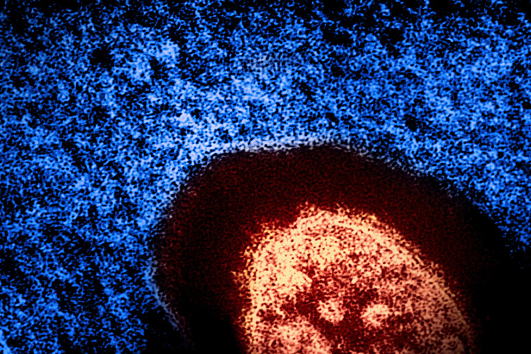 Beata Halassy: La científica que se inyectó virus cultivados en laboratorio para tratar su propio cáncer 3 Beata Halassy: La científica que se Inyectó virus cultivados en laboratorio para tratar su propio cáncer