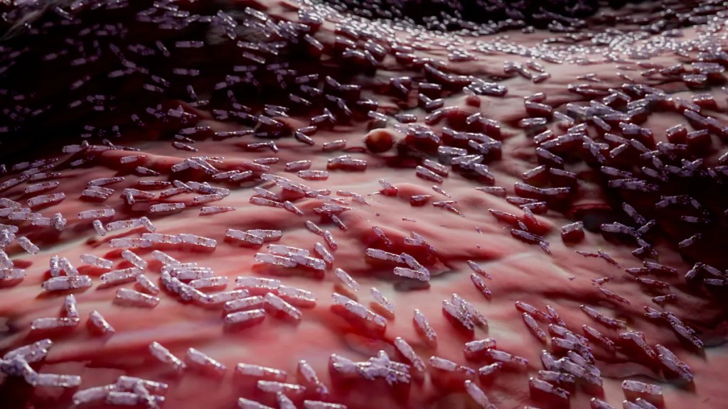 Nueva enfermedad infecciosa mortal en el mundo, y no es el COVID 1 Nueva enfermedad infecciosa mortal en el mundo, y no es el COVID