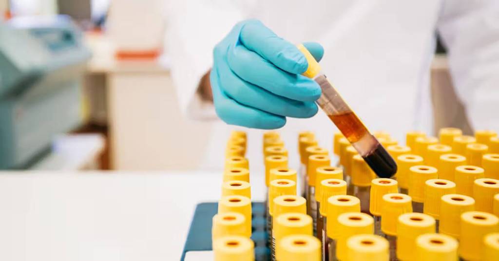 ¿Los viajes interestelares podrían ser una realidad gracias a la sangre de murciélago?