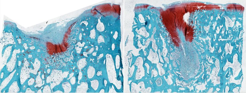 Crean un biomaterial que regenera totalmente el cartílago dañado de las articulaciones 2 Crean un biomaterial que regenera totalmente el cartílago dañado de las articulaciones