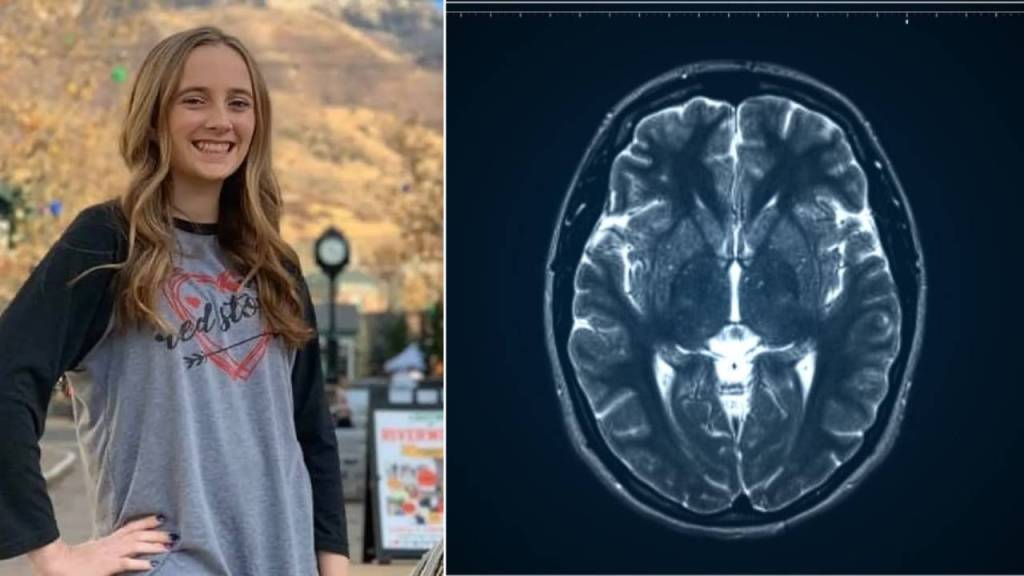 Riley Horner: La historia de cómo su memoria se reinicia cada dos horas después de un accidente