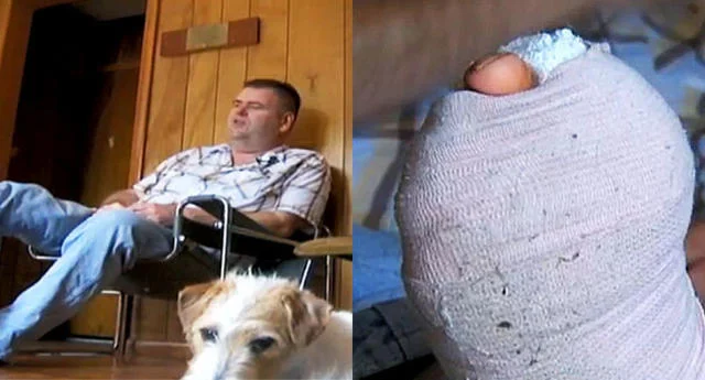 El perro que salvó a su dueño al morderle un dedo y la increíble historia que siguió