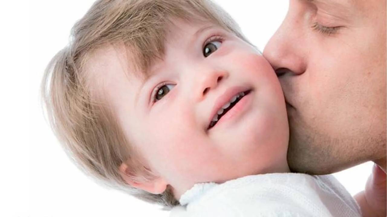 Logran eliminar cromosoma extra y ofrecer nuevas esperanzas para el tratamiento del síndrome de Down