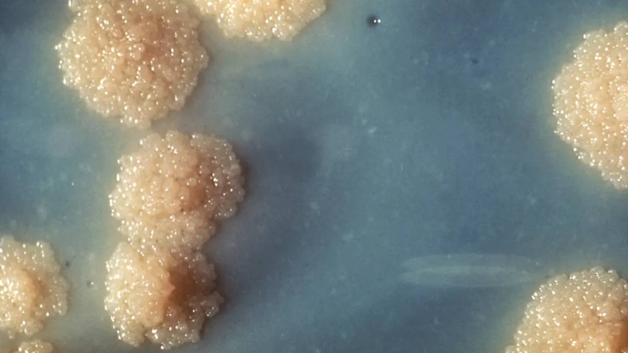 Una nueva vacuna de ARNm contra la mayor enfermedad infecciosa mortal del mundo