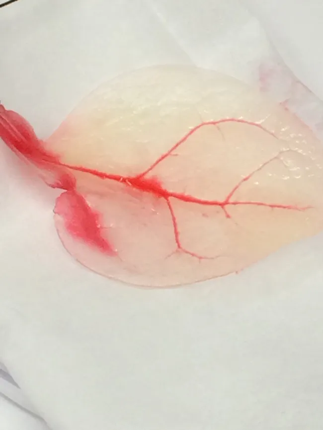Científicos usan hojas de espinacas para construir músculos del corazón humano