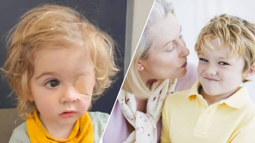 Niño pierde la visión de un ojo tras ser besado por una persona
