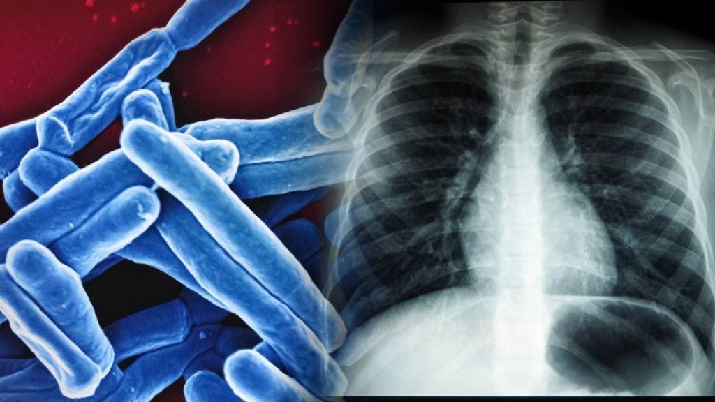 Una de las enfermedades infecciosas más mortíferas conocidas por el hombre ha sido revivida